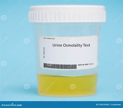 urine osmolality test bottle|how to check urine osmolality.